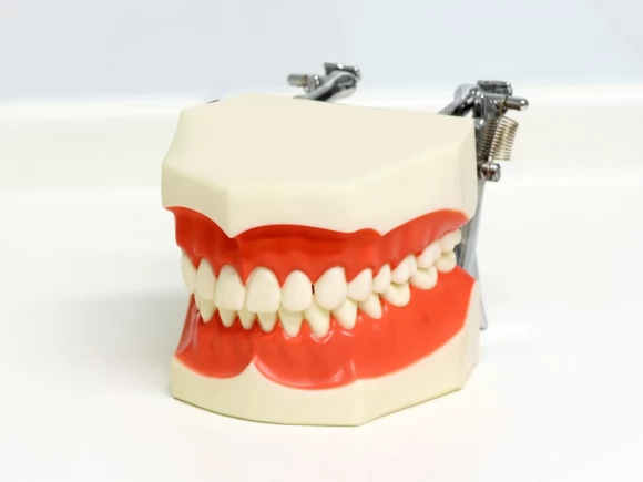 Da li su implantati dugotrajno rešenje za izgubljene zube?