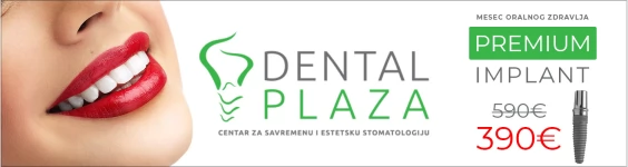 Ugradnja implanta, Stomatološka ordinacija, Beograd - Dental Plaza