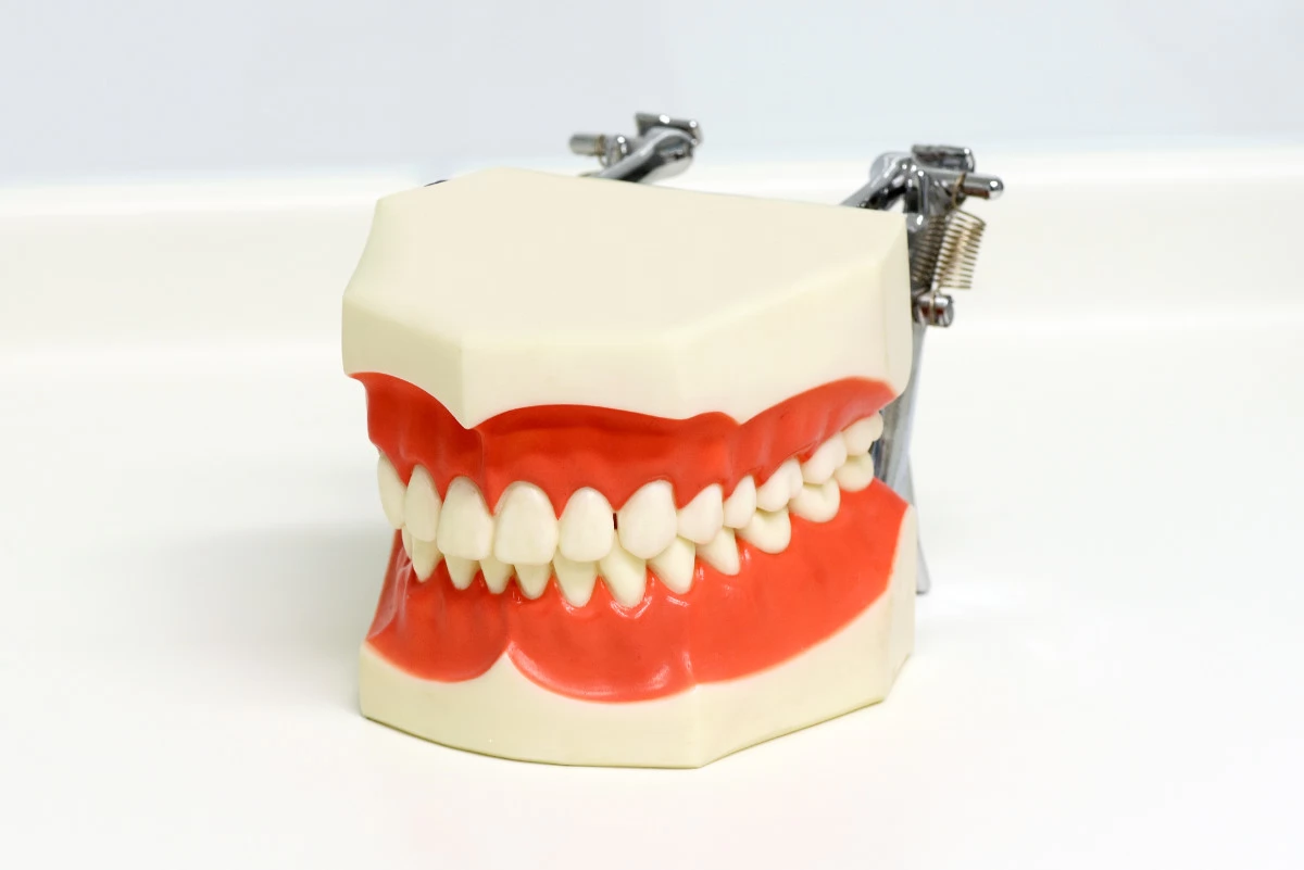 zubni-implanti